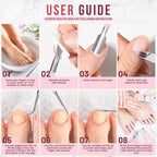 FANDAMEI Cuticle Kit, Cuticle Trimmer, Cuticle Nippers, Ingrown Toenail Removal - Image 7