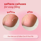 Onyx Professional Callus and Corn Peeling Gel, 4 fl oz - Image 4