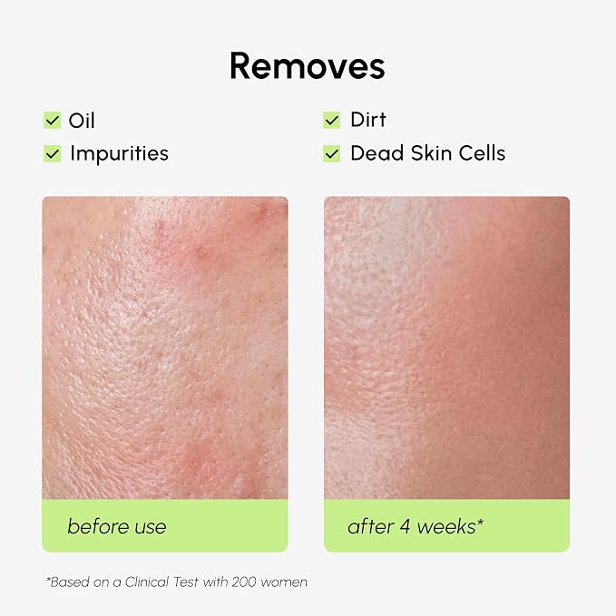 MAREE Exfoliating Toner with Salicylic Acid – AHA BHA Face Exfoliant & Pore - Image 5