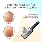 Microplane Colossal Foot File, Dead Skin/Callus Remover - Image 6
