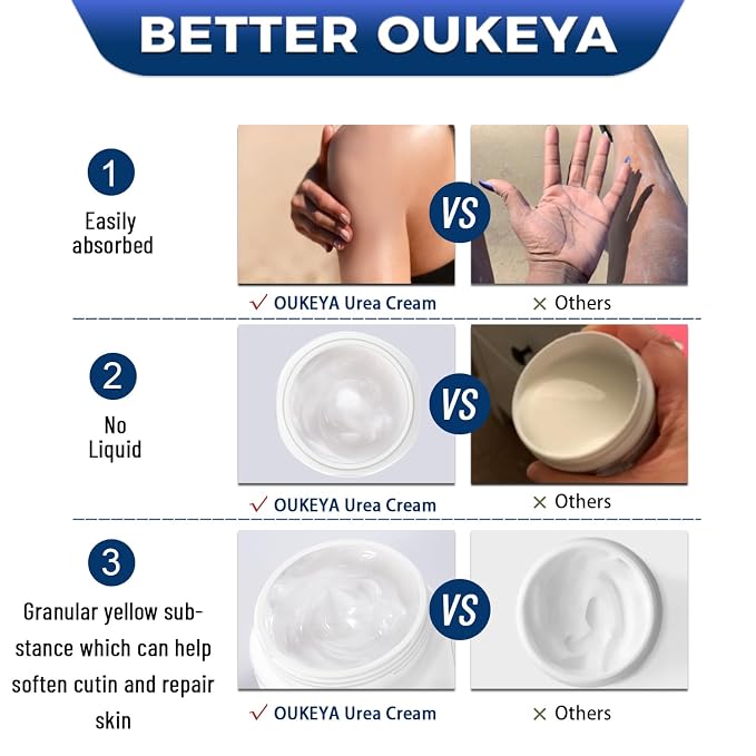 OUKEYA Urea Cream 40 Percent, Foot & Hand Cream - Image 6