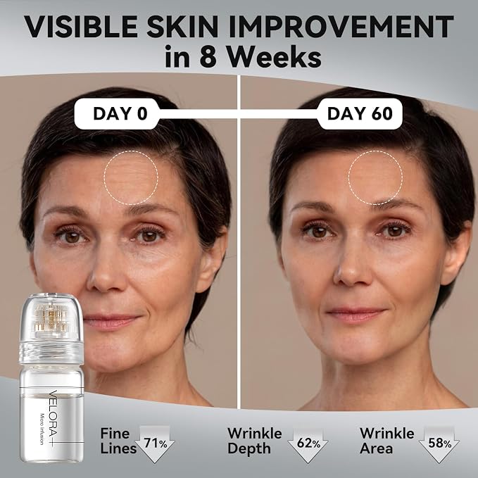 Micro Infusion System for Face - Image 7