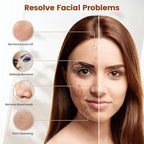 Facial Cleansing Brush, Electric Face Scrubber - Image 3