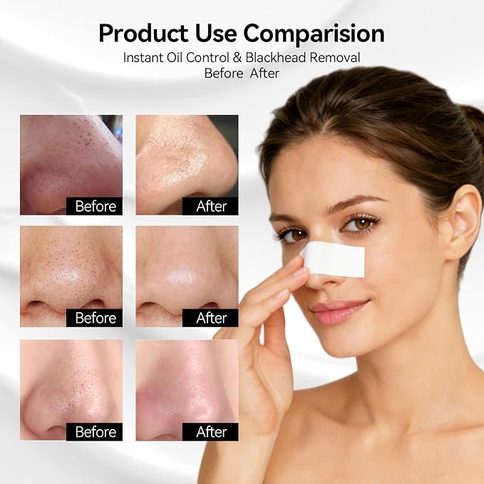 LANBENA 120 Pcs Nose Mask Strips Paper, Compatible - Image 4