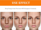 Toner for Dark Spots Turmeric Dark Spot Corrector, Facial Toner for Acne Prone - Image 2