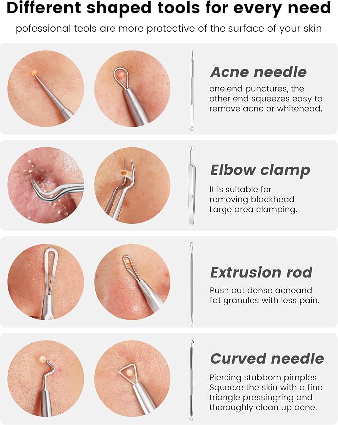 Pimple Popper Tool Kit - Image 4