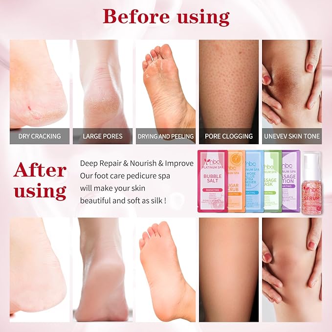 Pedicure Foot Soak Set - Image 3
