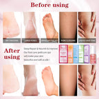 Pedicure Foot Soak Set - Image 3