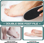 Lothee 30 Pack Foot File Foot Callus Remover Double Sided Professional - Image 5