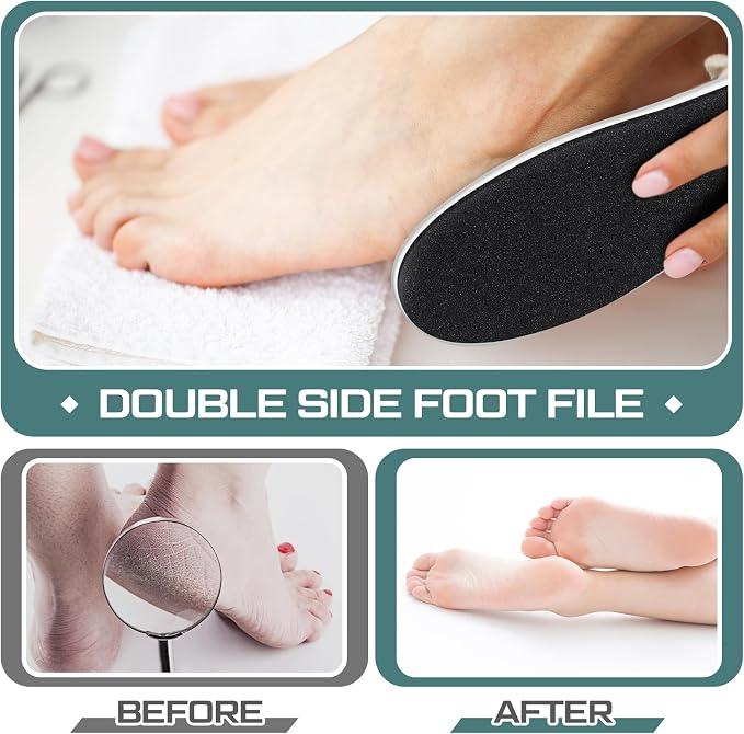 Lothee 30 Pack Foot File Foot Callus Remover Double Sided Professional - Image 5