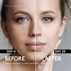 EnaSkin Dark Spot Remover Face & Body Serum: Age Spot Sun Spot Freckles Melasma - Image 3