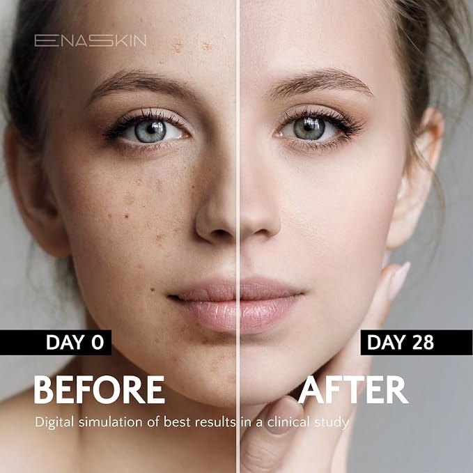EnaSkin Dark Spot Remover Face & Body Serum: Age Spot Sun Spot Freckles Melasma - Image 3