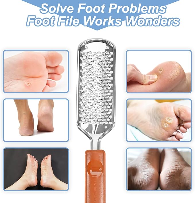 Professional Foot Scrubber Dead Skin Remover, Pedicure Foot File Callus Removal - Image 3
