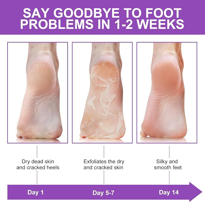 Foot Peeling Mask 5 Pack, Foot Peel Mask Remove Dead Skin, Rough Callus and - Image 6