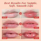 ANAI RUI Cherry Lip Scrub & Lip Mask Set, Vitamin E, Lip Scrub - Image 7