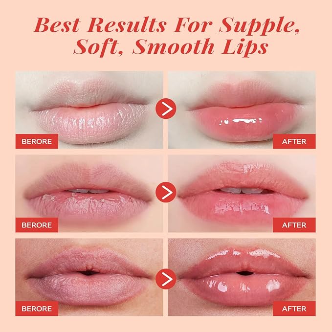 ANAI RUI Cherry Lip Scrub & Lip Mask Set, Vitamin E, Lip Scrub - Image 7