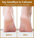 Nano Glass Foot File, Double-Sided Foot Callus Remover Feet Scrubber Hard & - Image 6