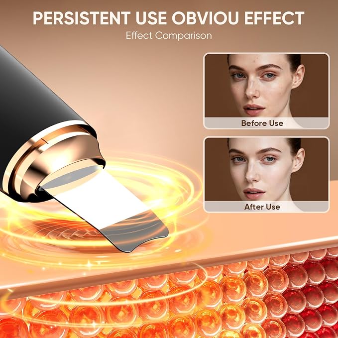 Silicone Face Scrubber Blackhead Scraper Rechargeable 2-in-1 Facial Cleansing - Image 5