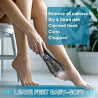 Callus Remover for Feet - Image 6
