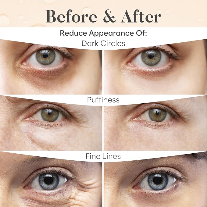 AURAE Variety Under Eye Patches - Image 4