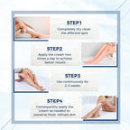 OUKEYA Urea Cream 40 Percent, Foot & Hand Cream - Image 4