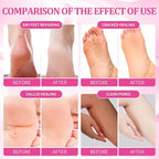 Pedicure Kit Foot Soak Set: Bubble Salt, Sugar Scrub, Massage Mask, Massage - Image 3