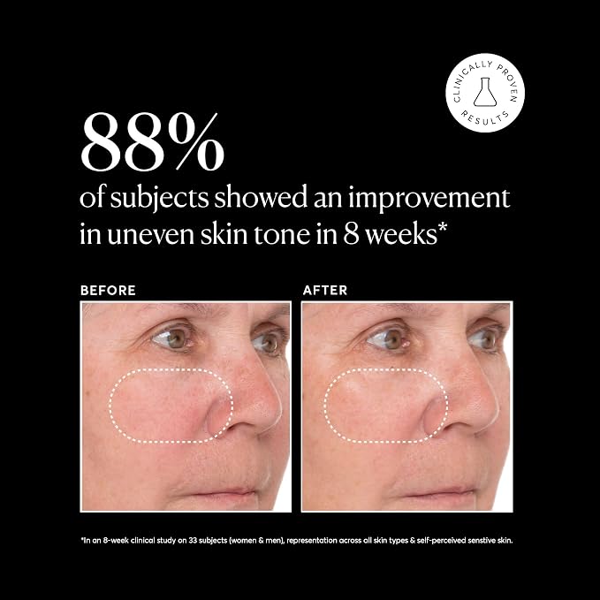 Naturium Vitamin C Super Serum Plus, Smoothing Face Care, plus Retinol - Image 5