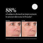 Naturium Vitamin C Super Serum Plus Jumbo, Smoothing Face Care, plus Retinol - Image 5
