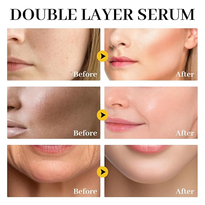 White Truffle First Spray Serum Deep Hydrating Face Mist Light-Weight Facial - Image 6