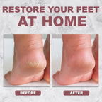 1pc Callus Remover Tool in Pink - Image 5