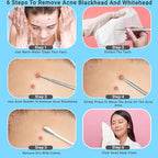 EFAH Care 2Pcs Stainless Steel Pimple Extractor Acne Treatment Tool Surgical - Image 6