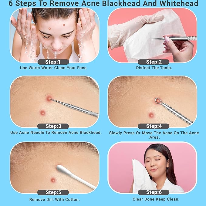 EFAH Care 2Pcs Stainless Steel Pimple Extractor Acne Treatment Tool Surgical - Image 6