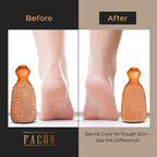 Facón Pumice Stone for Feet Callus Remover - Image 6