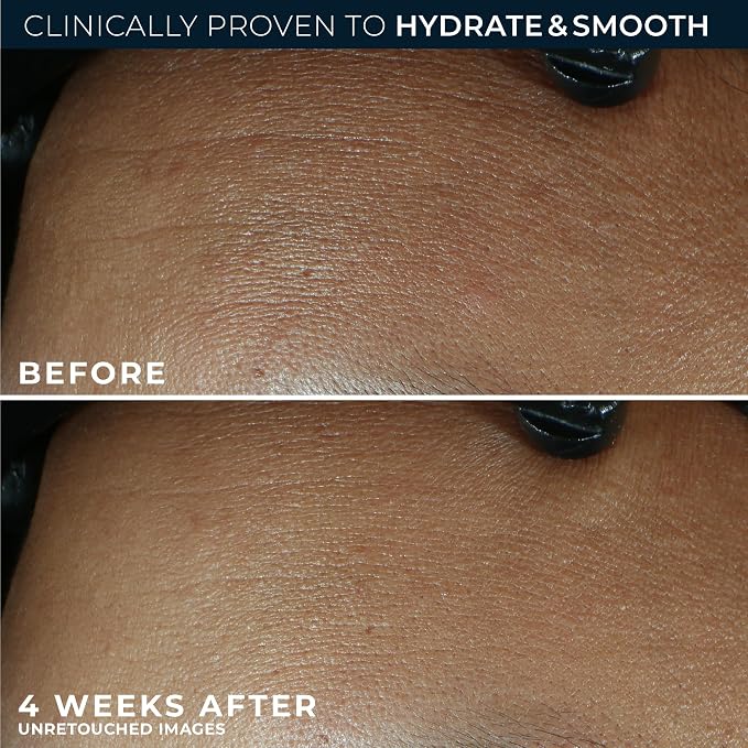RoC Retinol Correxion Max Daily Hydration Anti-Aging Face Moisturizer - Image 4