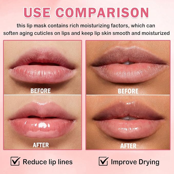 Honey Pot Lip Balm, Moisturizing and Repair Bee Lip Balm Honey Pot, Prevention - Image 4