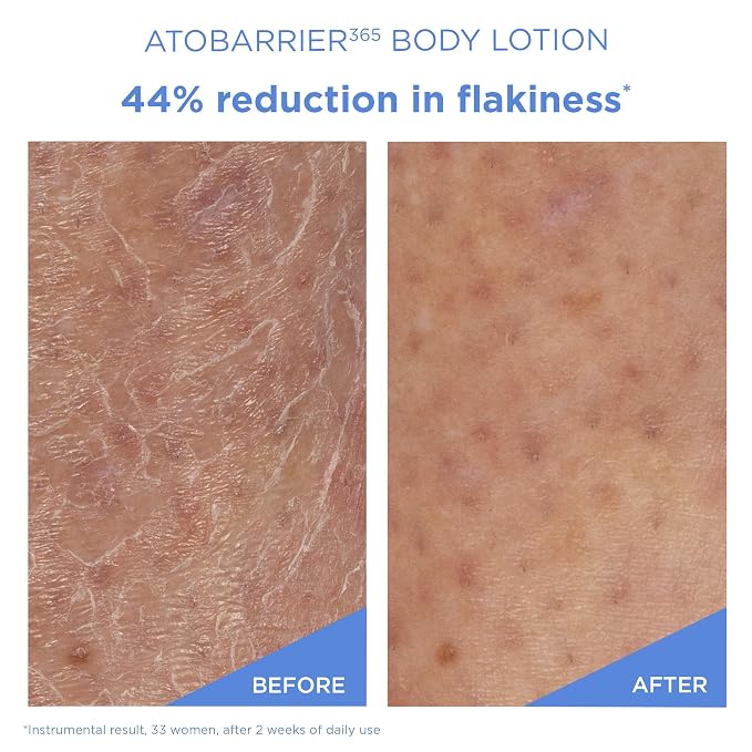 AESTURA ATOBARRIER365 Korean Body Lotion - Image 3