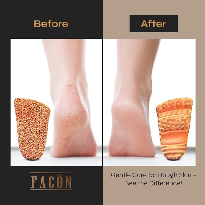 Facón Pumice Stone for Feet Callus Remover - Image 6