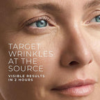 RoC Retinol Correxion Deep Wrinkle Non-Invasive Targeted Patches - Image 2