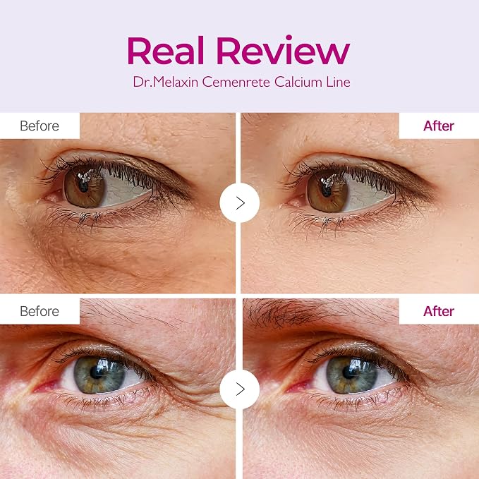 Dr.Melaxin Cemenrete Calcium Volume Eye Patch - Image 3