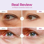 Dr.Melaxin Cemenrete Calcium Volume Eye Patch - Image 3