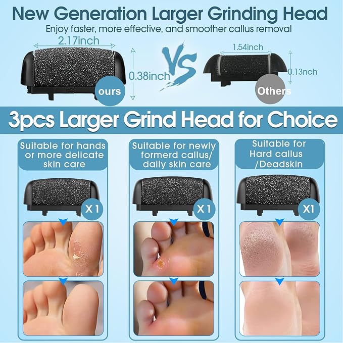 Callus Remover for Feet - Image 3