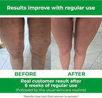 TESMED Cellulite Manual Massager : Made in Italy, Patented - Image 4