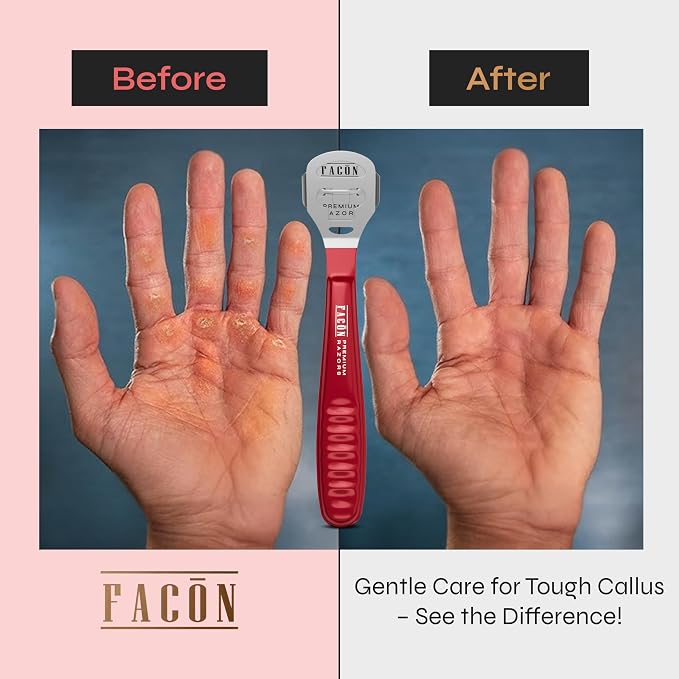 Facón Professional Callus Shaver Remover - Image 4