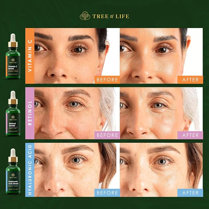 Tree of Life Face Serum Set - Image 7