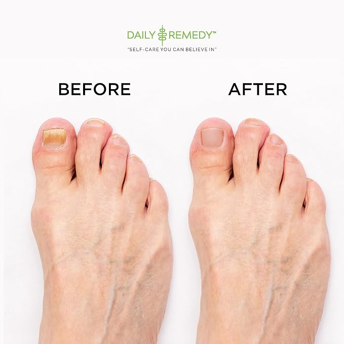 DAILY REMEDY EXTRA STRENGTH Tea Tree Oil Foot Soak w/ Epsom Salt Made in USA - Image 4