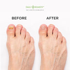 DAILY REMEDY EXTRA STRENGTH Tea Tree Oil Foot Soak w/ Epsom Salt Made in USA - Image 4
