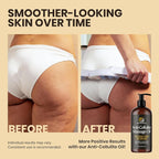 Anti Cellulite Roller & Lymphatic Drainage Massager | Fascia Blaster - Image 6