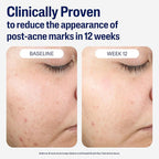 CETAPHIL Gentle Clear Repairing Post-Acne Serum, Retinol Alternative, Oil Free - Image 5