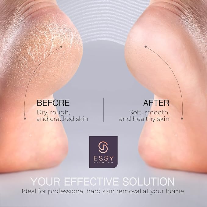Essy Electric Foot File Hard Skin Remover - Image 5
