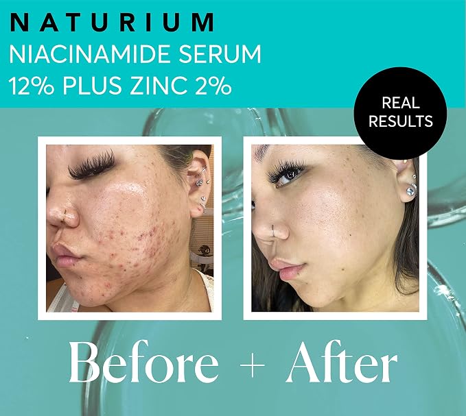 Naturium Niacinamide Face Serum 12% Plus Zinc 2% Jumbo, Anti-Aging, Pore - Image 5